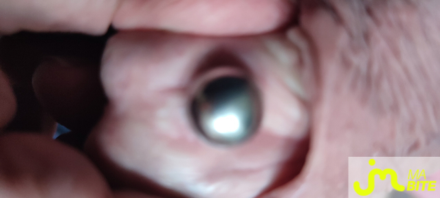 bites de Piercing 