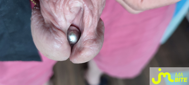 bites de Piercing 