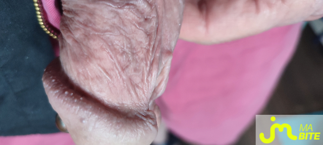 bites de Piercing 