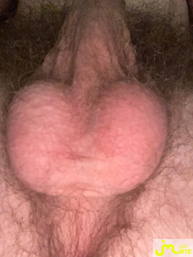 bites de Bitede15cm1567