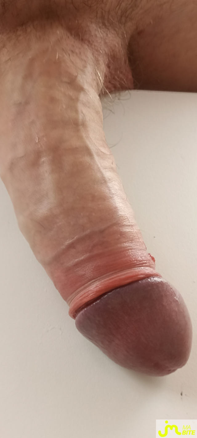 bites de C&eacute;lestyn