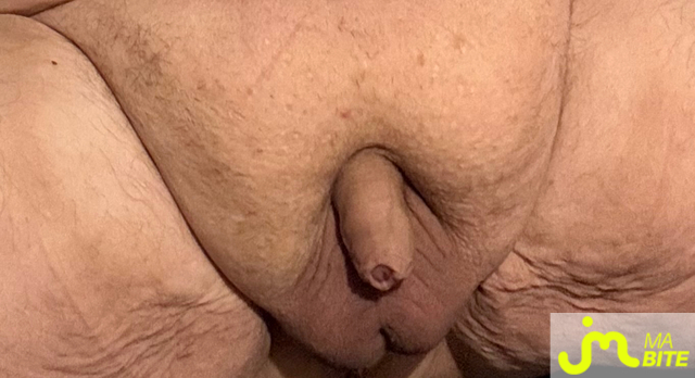 bites de Vix44