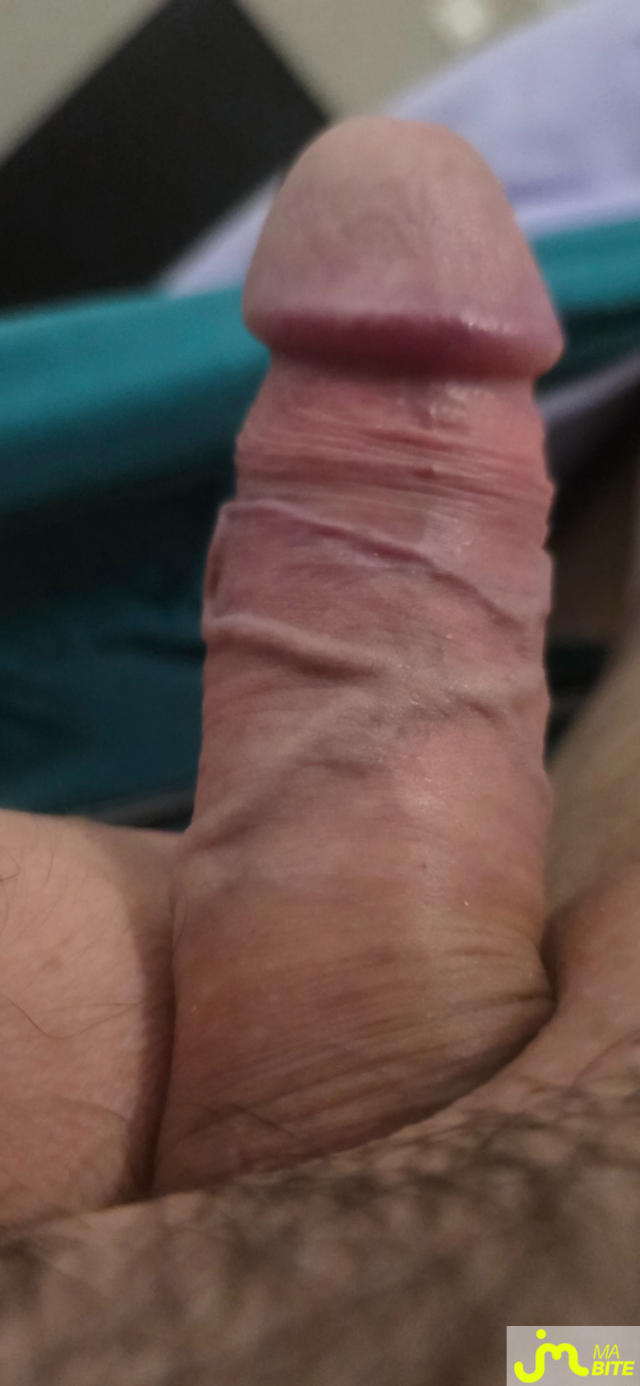bites de bite_&ocirc;_veines