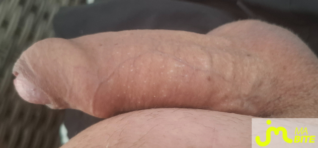 bites de Domic