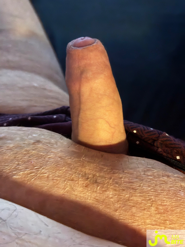 bites de Vix44