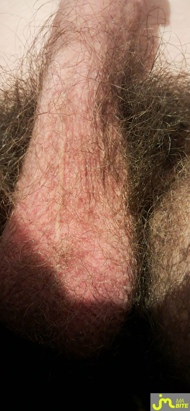 bites de Killian13