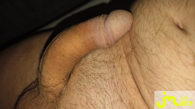 bites de van3005