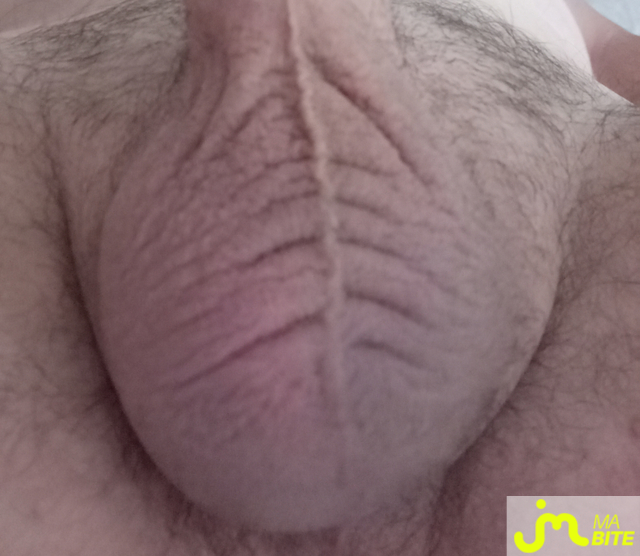 bites de lcmr