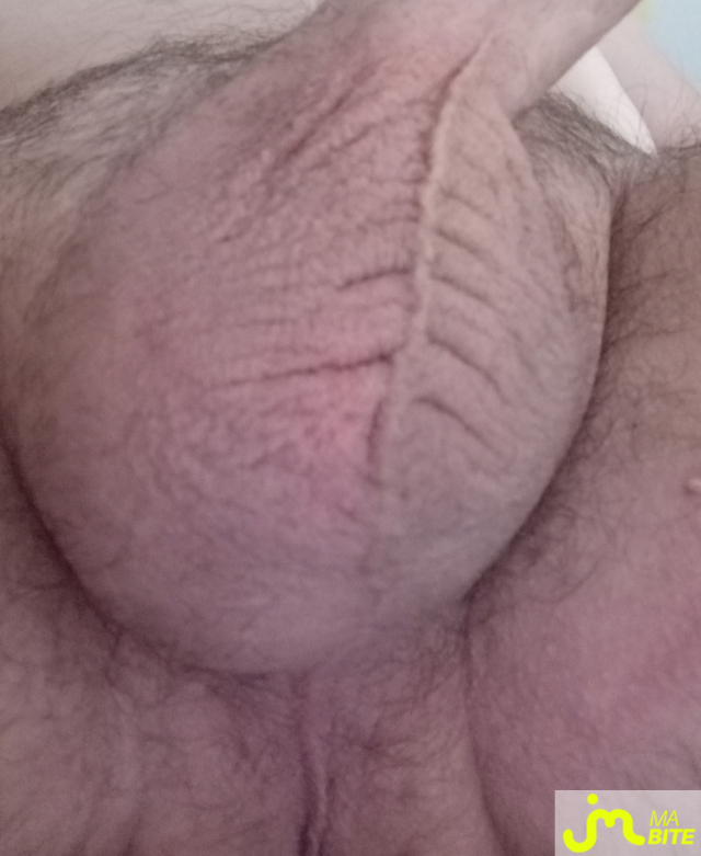 bites de lcmr