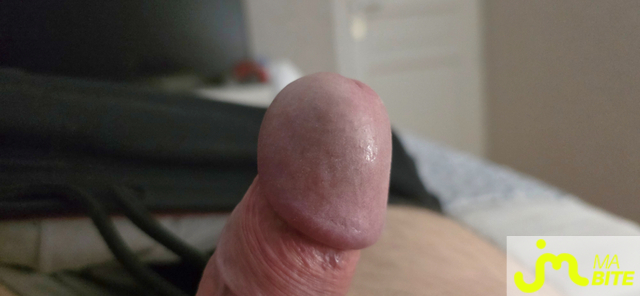bites de bite_&ocirc;_veines