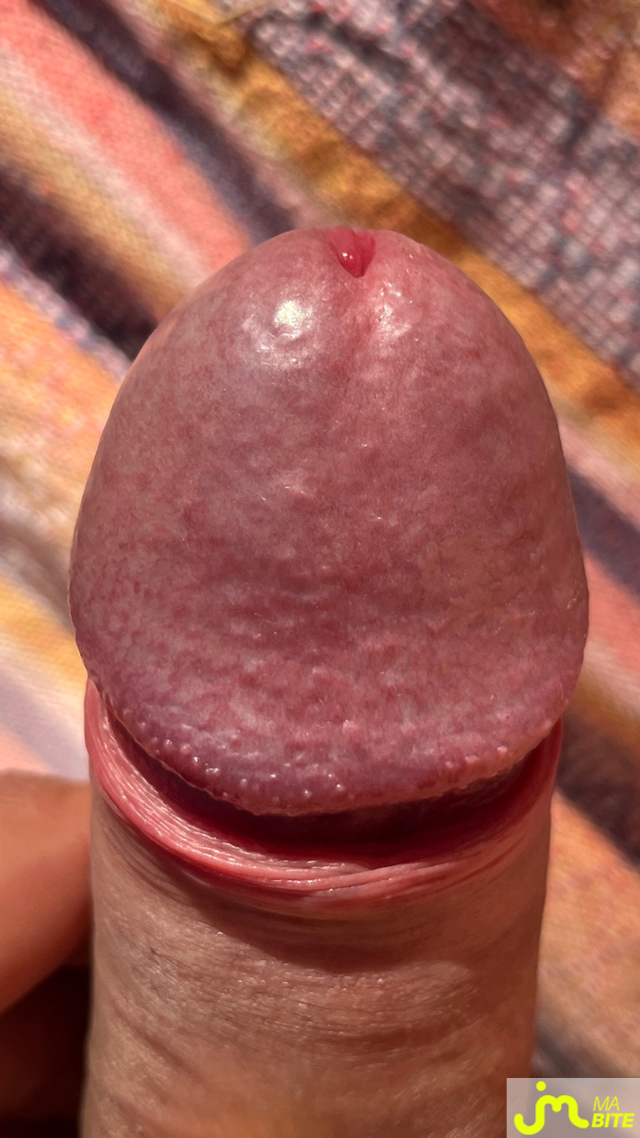 bites de Jessito