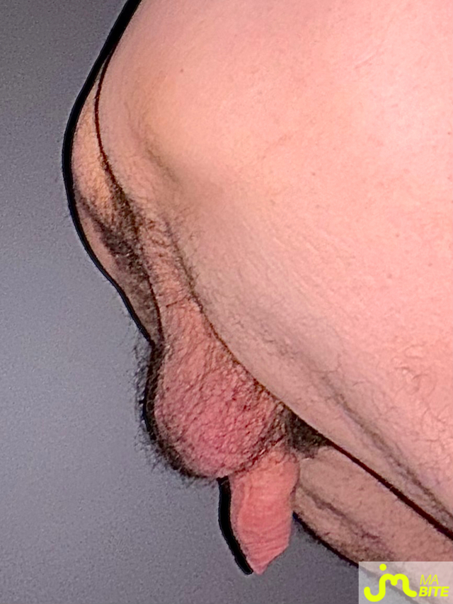 bites de 13x13
