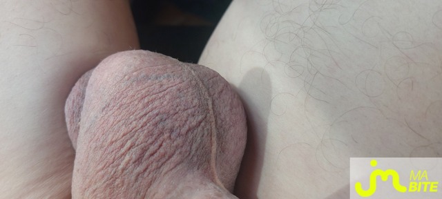bites de PLUGMAN