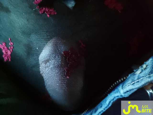 bites de Charlingerie