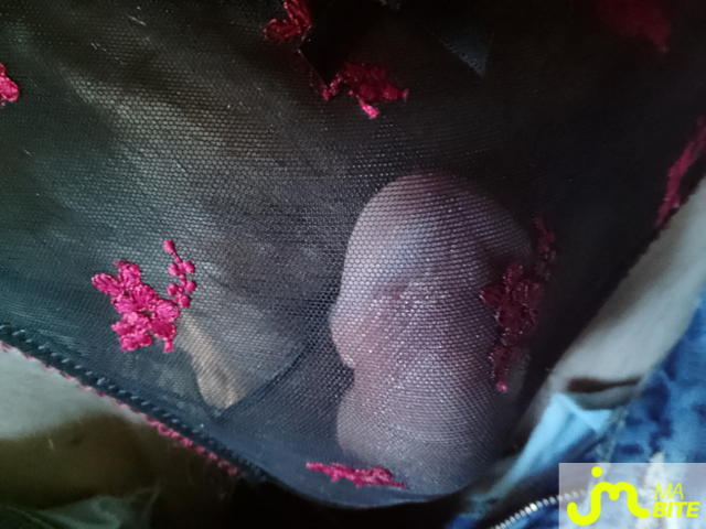 bites de Charlingerie