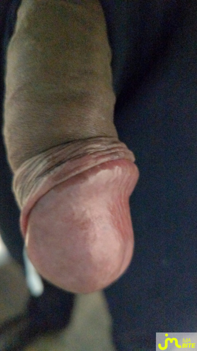 bites de Blackmiel