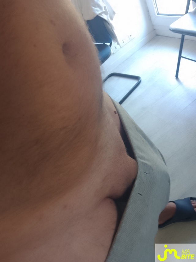 bites de sc&eacute;nario