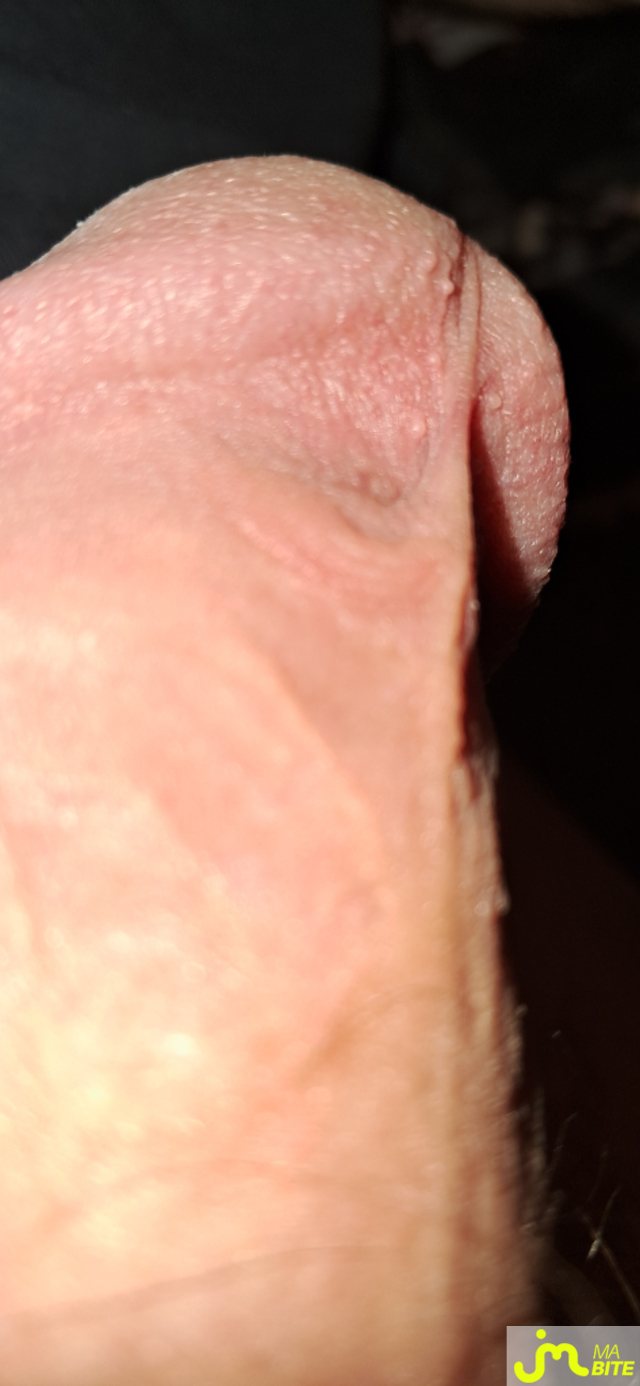 bites de Killian13