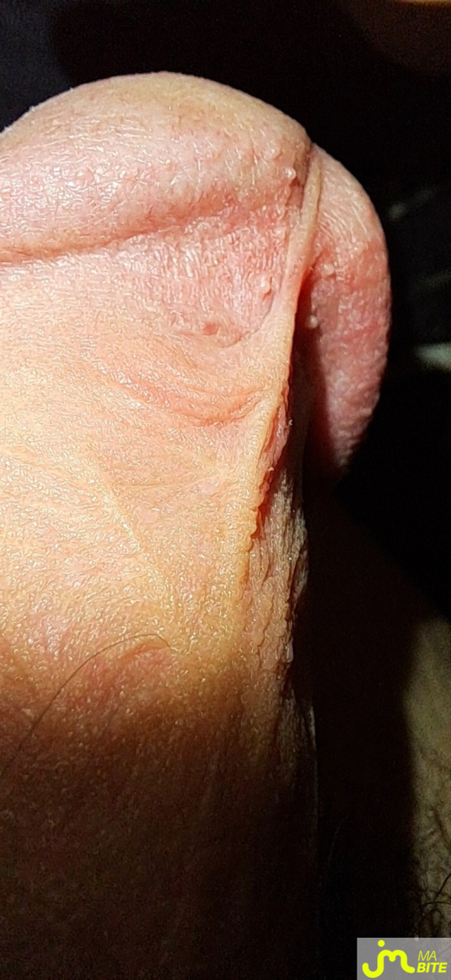 bites de Killian13
