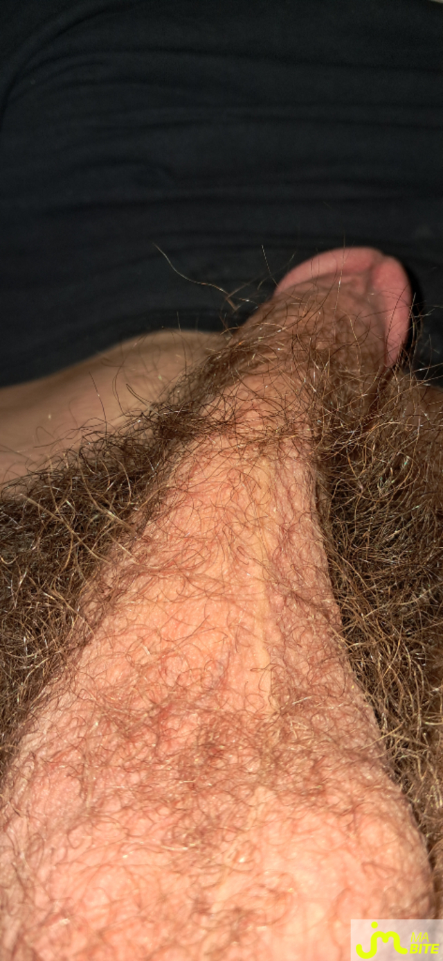 bites de Killian13