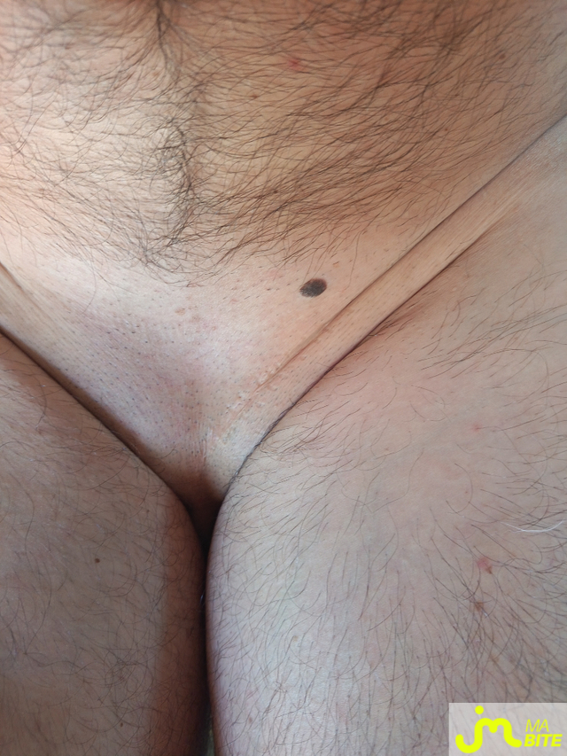 bites de Manstring