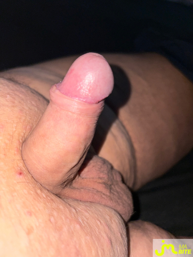 bites de Vix44