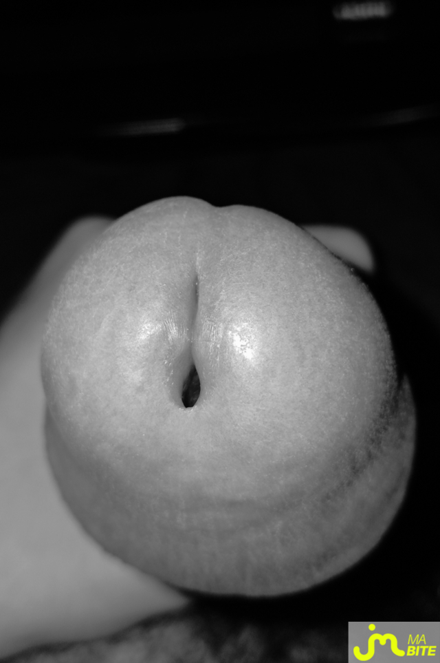 bites de Killian13