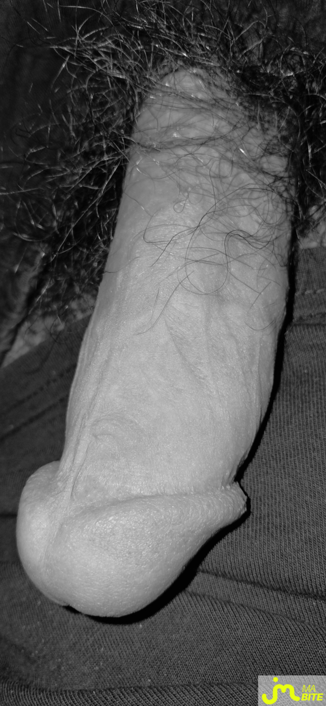 bites de Killian13