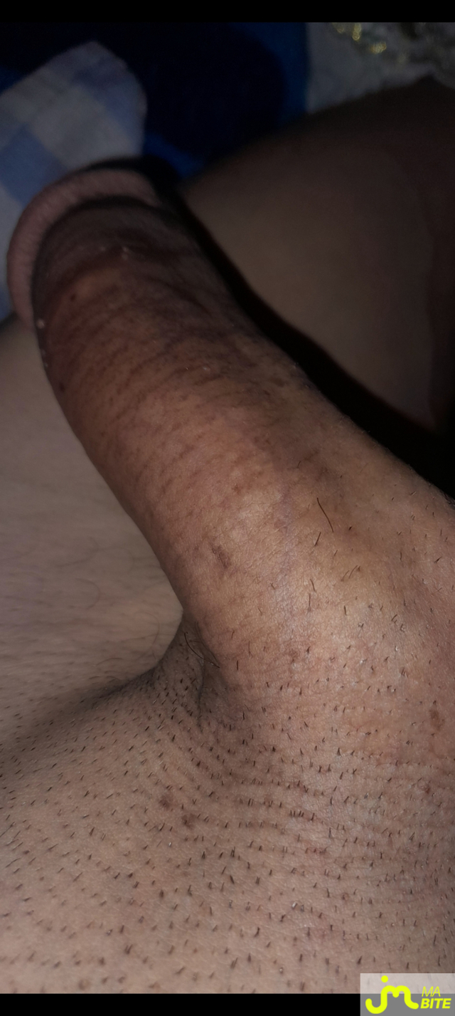 bites de Hotmoroccan 