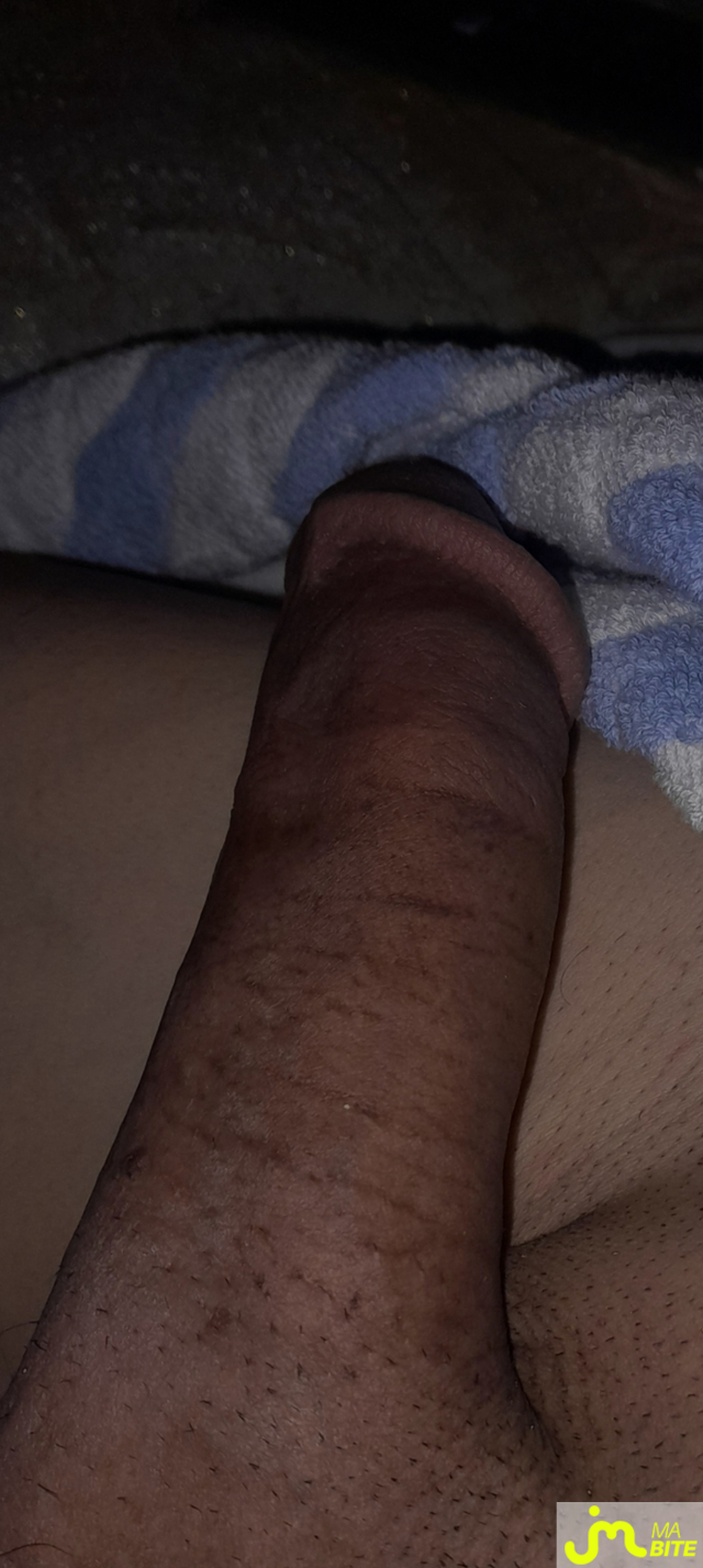 bites de Hotmoroccan 