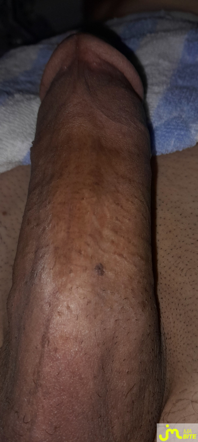 bites de Hotmoroccan 