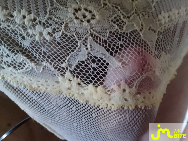 bites de Charlingerie