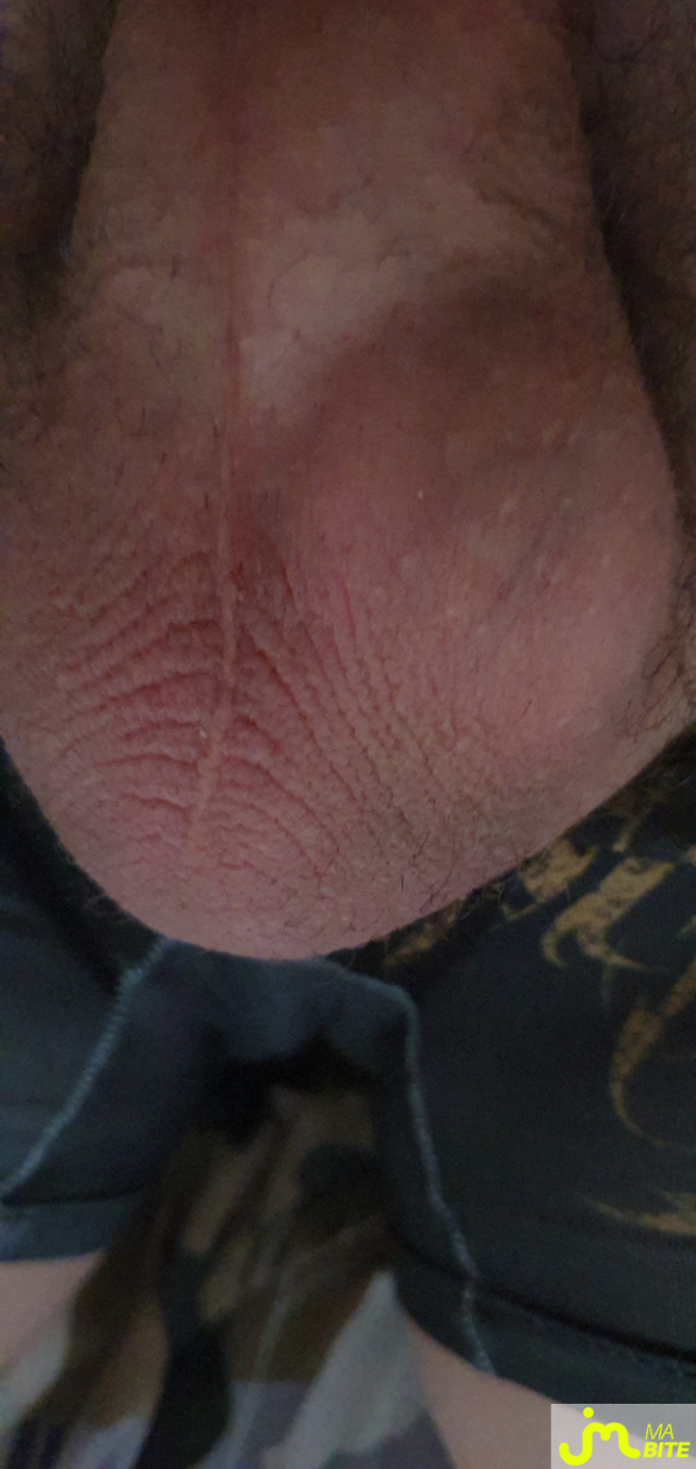 bites de Mik micka