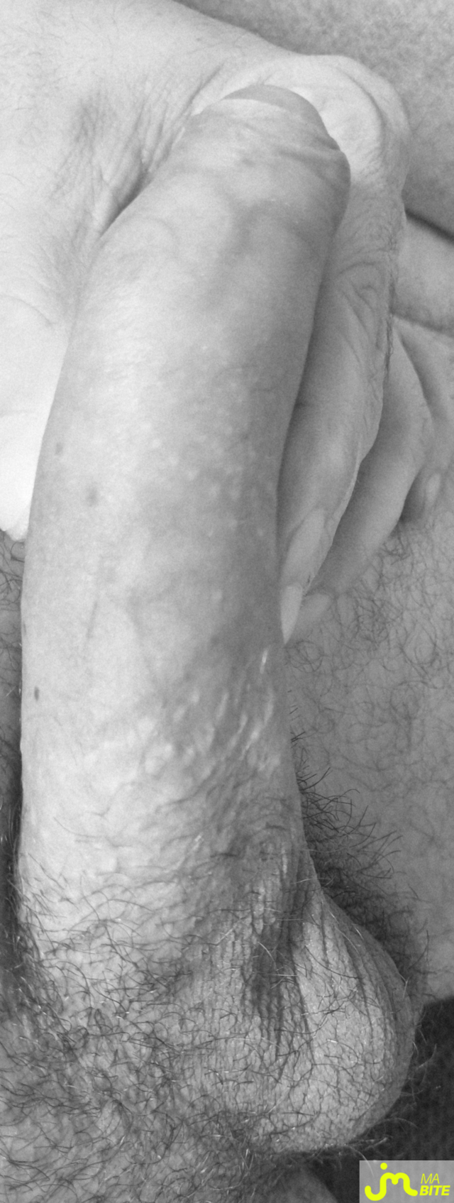 bites de coquindu766