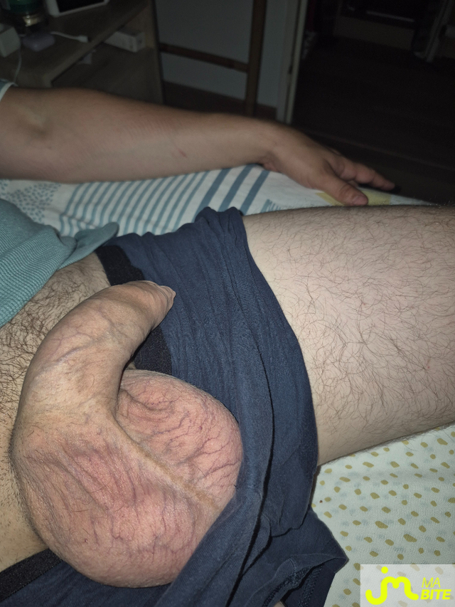 bites de Teddu33