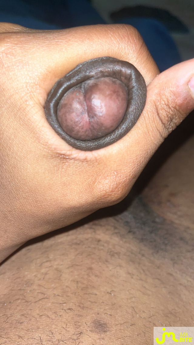 bites de Abdexs