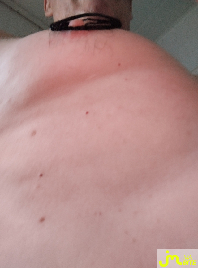 bites de benolt 