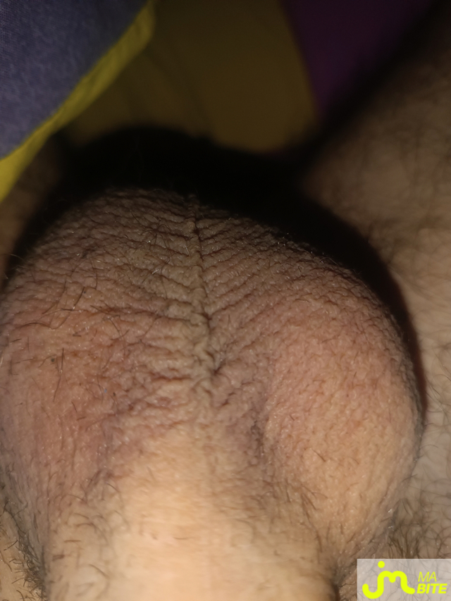 bites de pr&eacute;puce 29