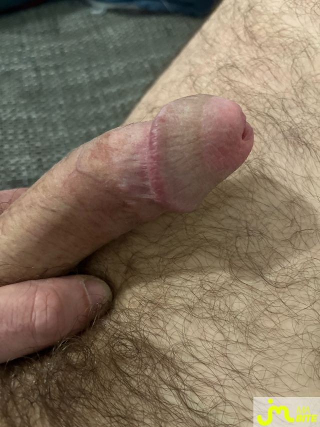 bites de Mecsympa57