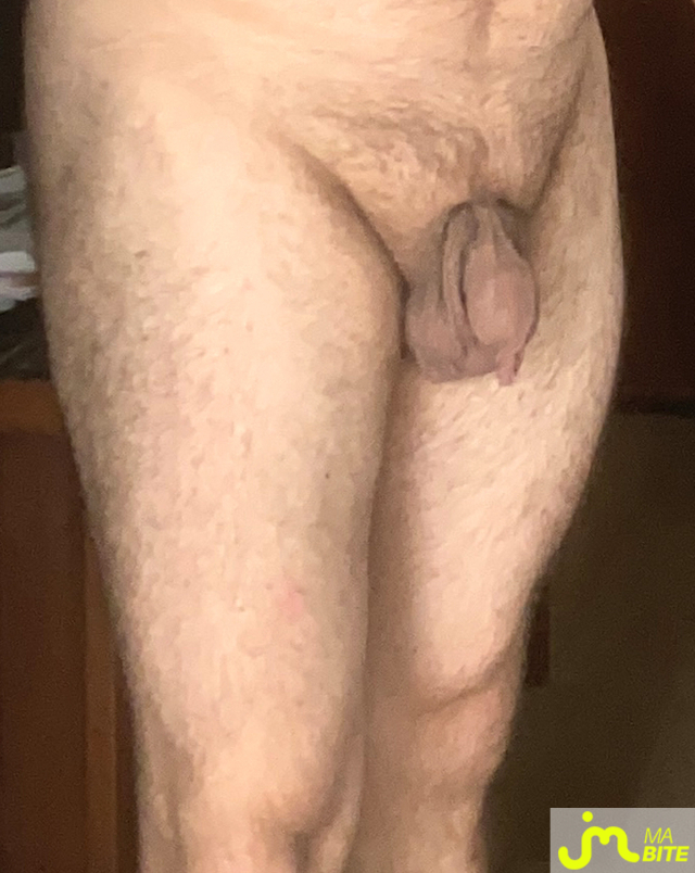 bites de LittelHyde