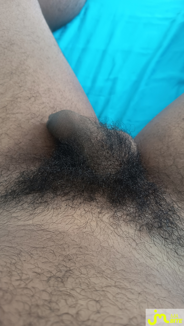 bites de fly9741000