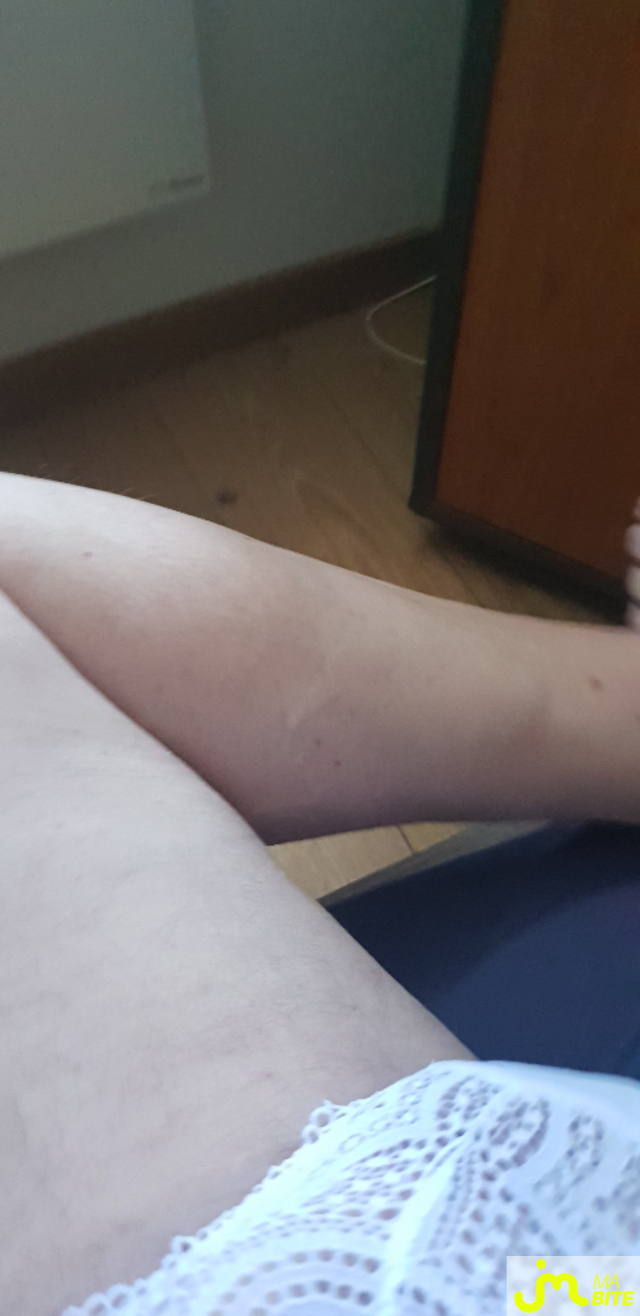 bites de Baf