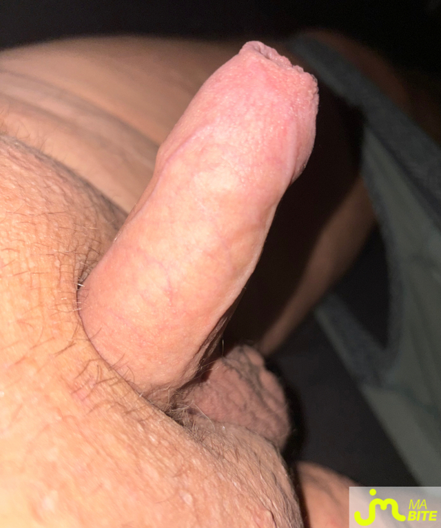 bites de Vix44