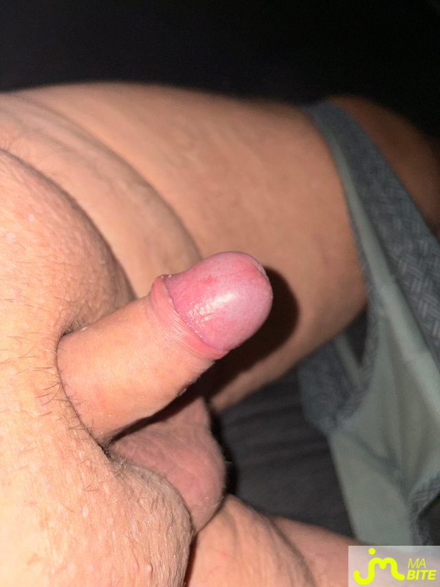 bites de Vix44