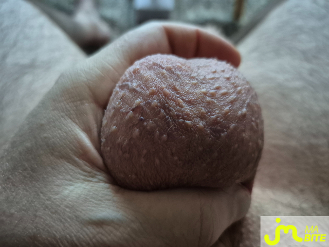 bites de Mmmmhhhh