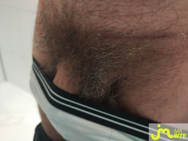 bites de Jorge99