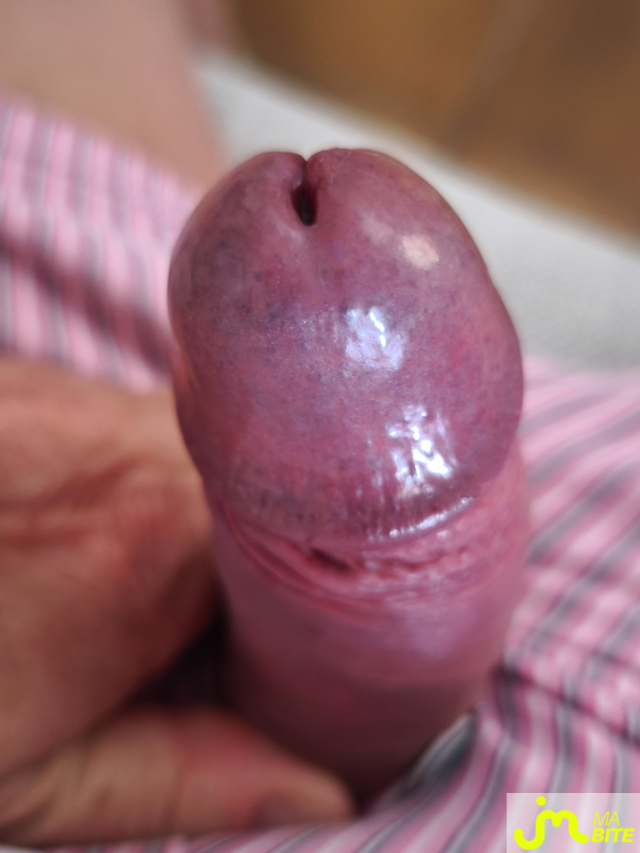bites de Murcoquin31