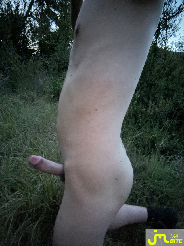 bites de Mathis_91