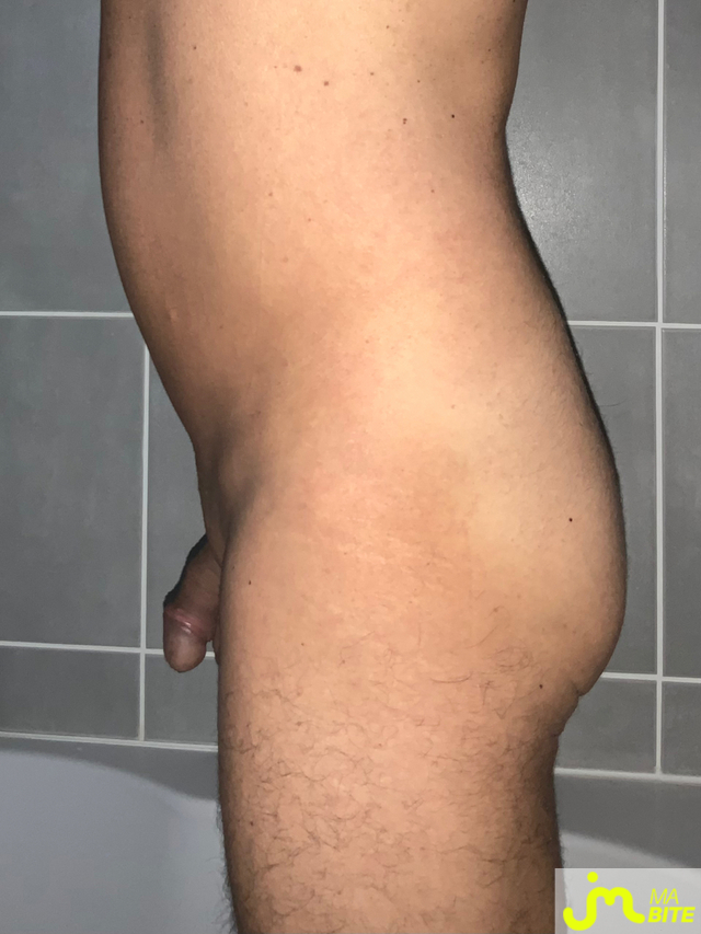bites de Bicool95