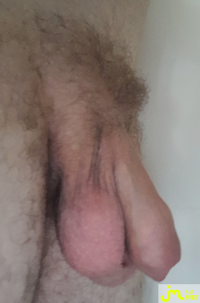 bites de St&eacute;ph35000